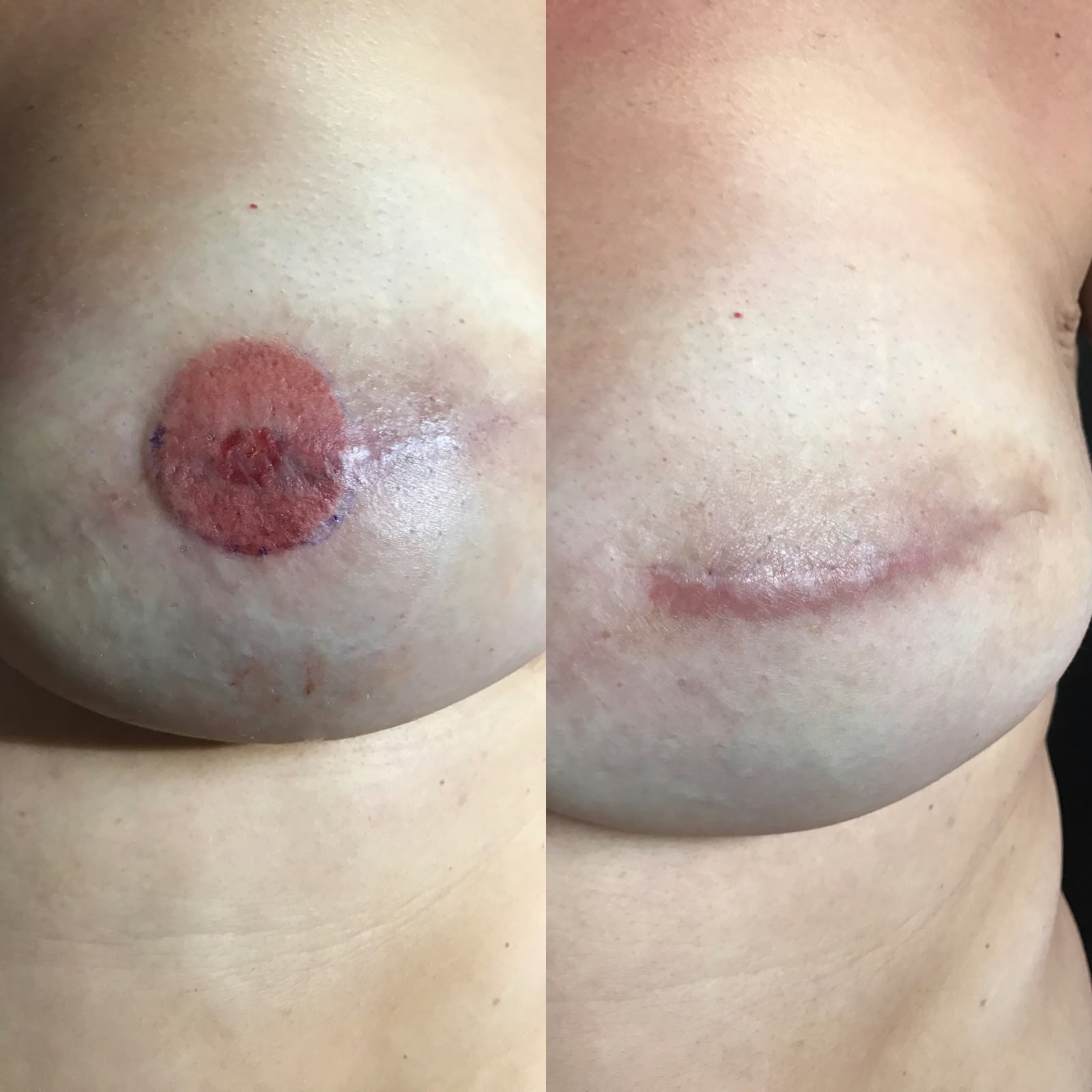 Las Tetas Felices - resultado 3
